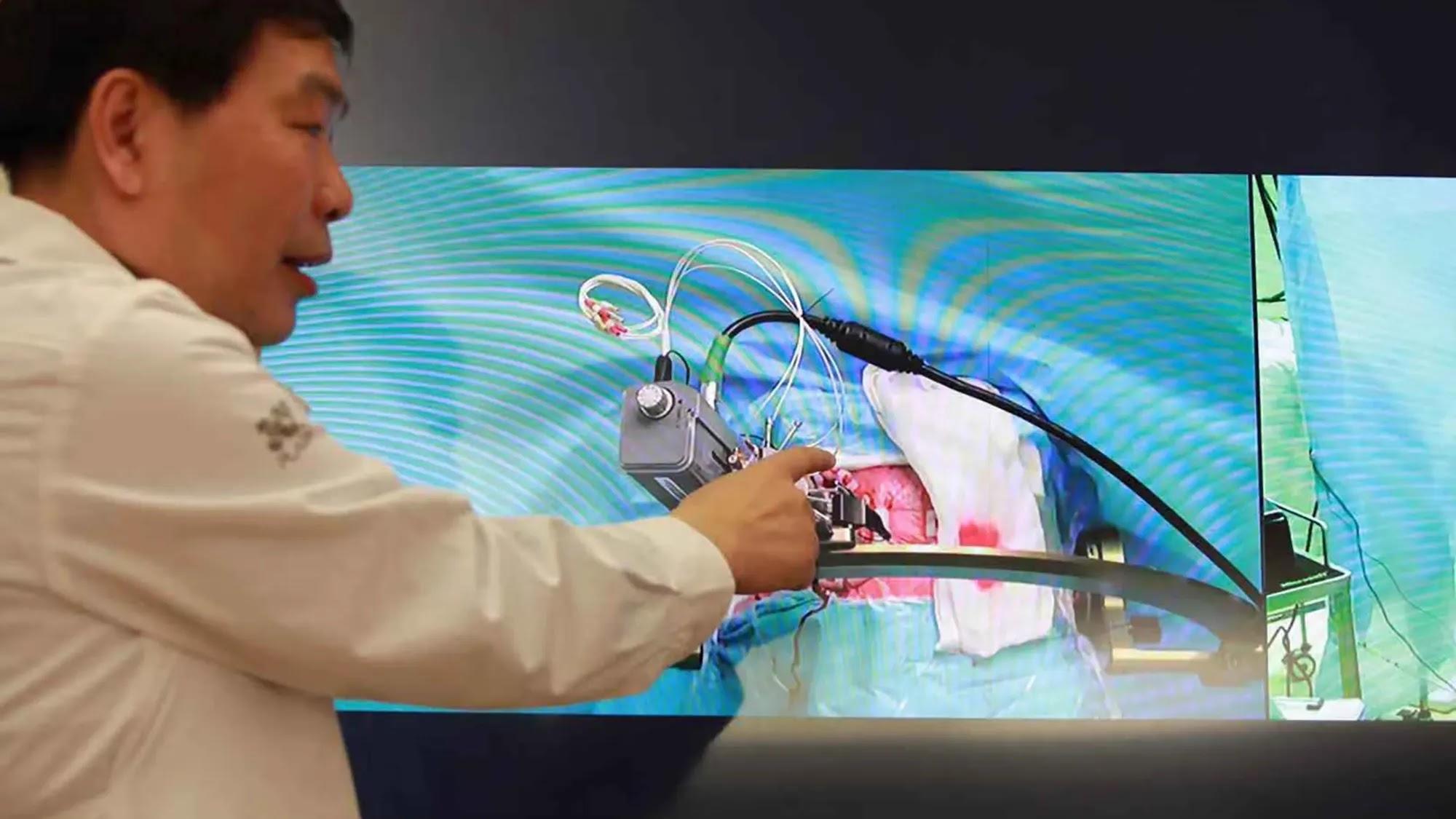 China realizó su primera incorporación de cirugía cerebral remota 5G con Huawei